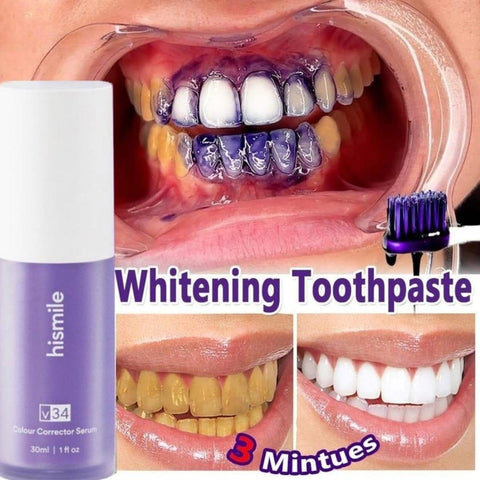 Teeth Whitening Teeth Whitening Pen
